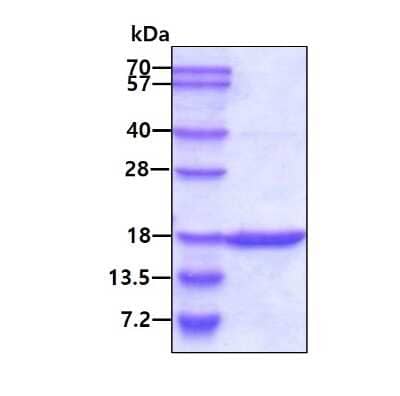 SDS-Page: Recombinant Human GMFG Protein [NBC1-19063] - 3ug by SDS-PAGE under reducing condition and visualized by coomassie blue stain.